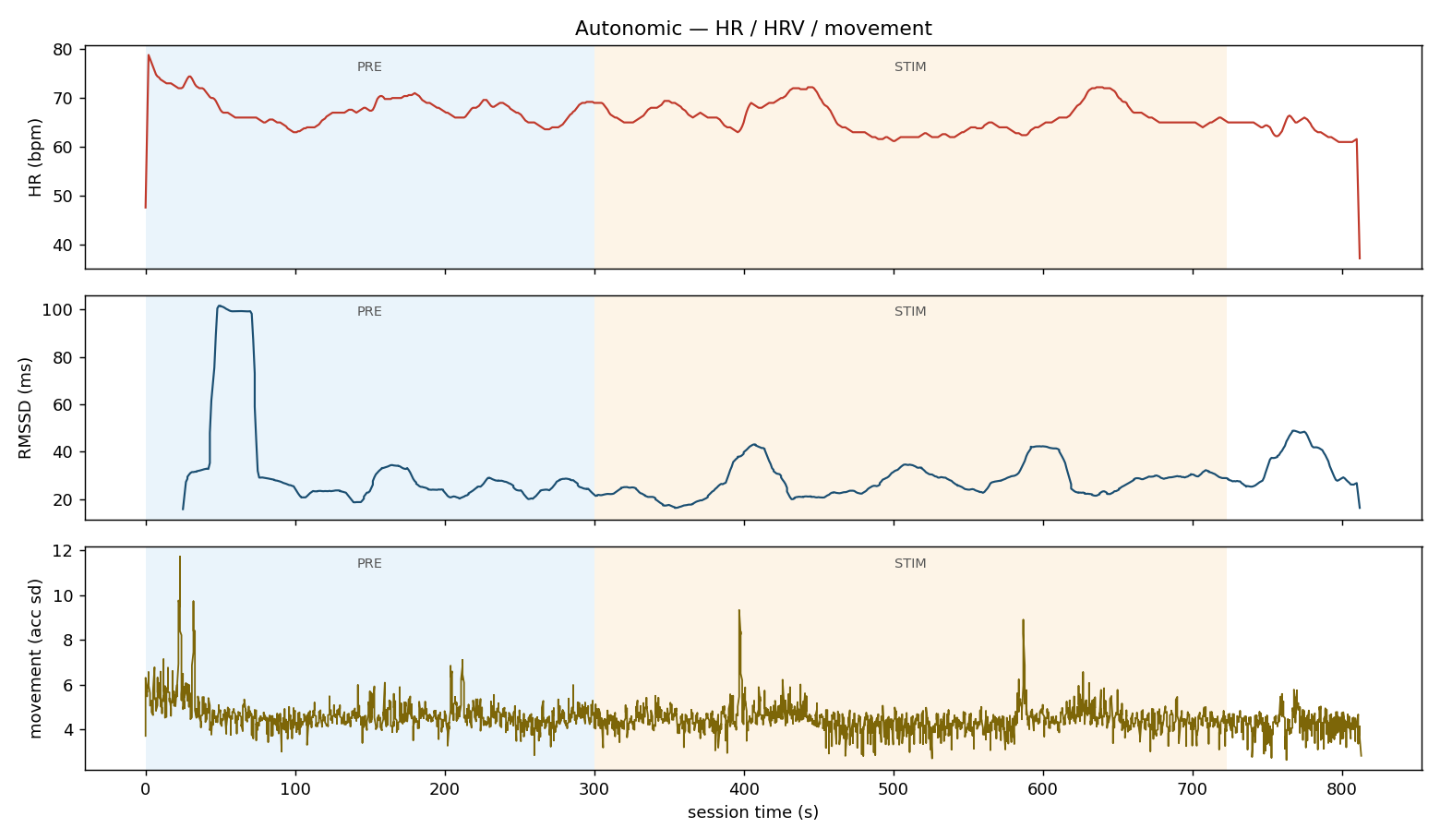 Chart of heart rate, rMSSD, and movement across a pre period and a stimulation period from a Zencora research session
